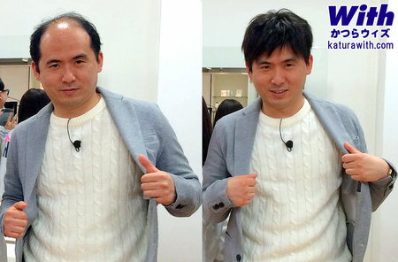 beforeafter.jpg